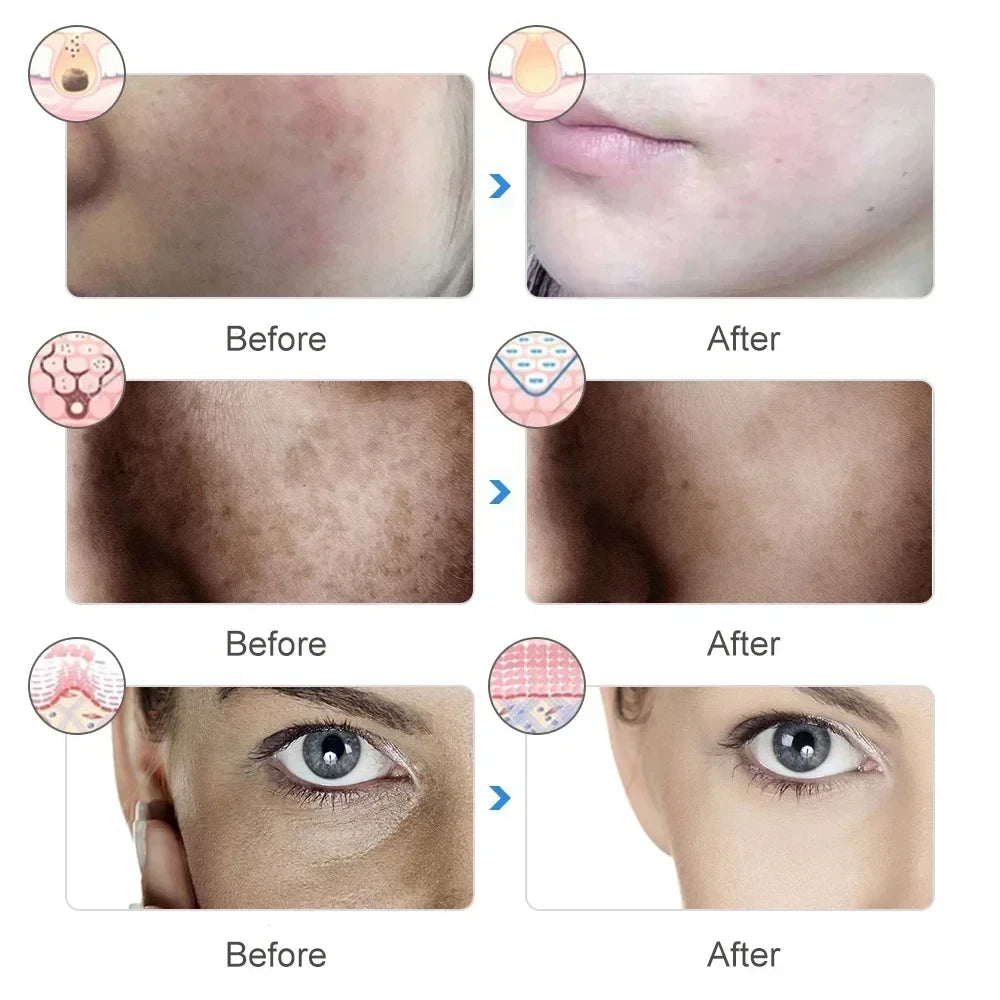 Mascara Facial LED de Terapia de Luz